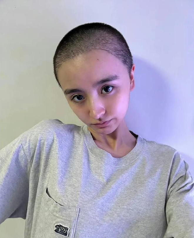 金子涵直播疑似求救：脸部被注射50针不明物质，不服从便会头痛 - 8