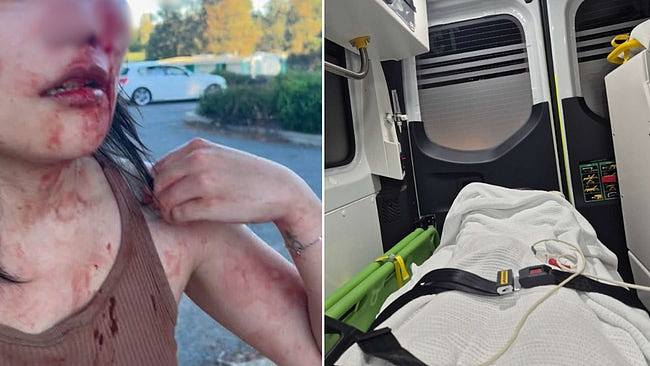 27岁华女澳洲遇种族歧视辱骂，再被狂殴至满面血！需辞职休养（组图） - 1