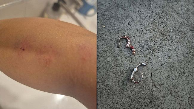 27岁华女澳洲遇种族歧视辱骂，再被狂殴至满面血！需辞职休养（组图） - 3