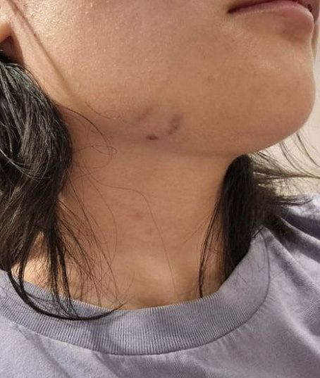 27岁华女澳洲遇种族歧视辱骂，再被狂殴至满面血！需辞职休养（组图） - 4