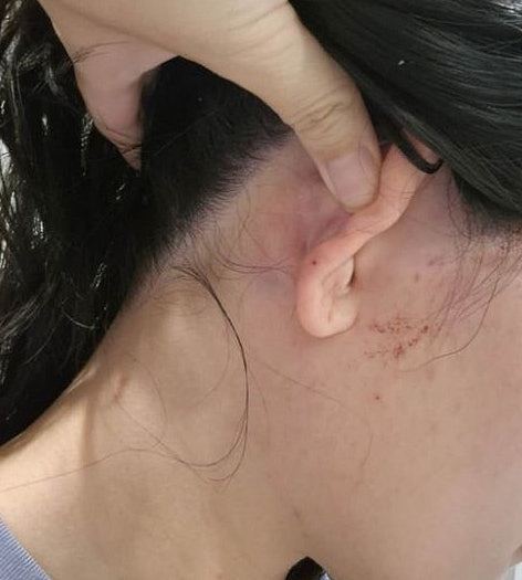27岁华女澳洲遇种族歧视辱骂，再被狂殴至满面血！需辞职休养（组图） - 5