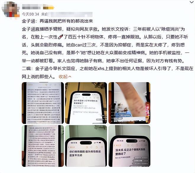 王思聪陷医美丑闻股份遭冻结，前女友黄一鸣被限高反向喊话王健林 - 10