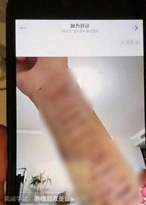 陪玩陪睡不算啥！继注射不明物体后，内娱又传噩耗连杨紫也被牵连（组图） - 2
