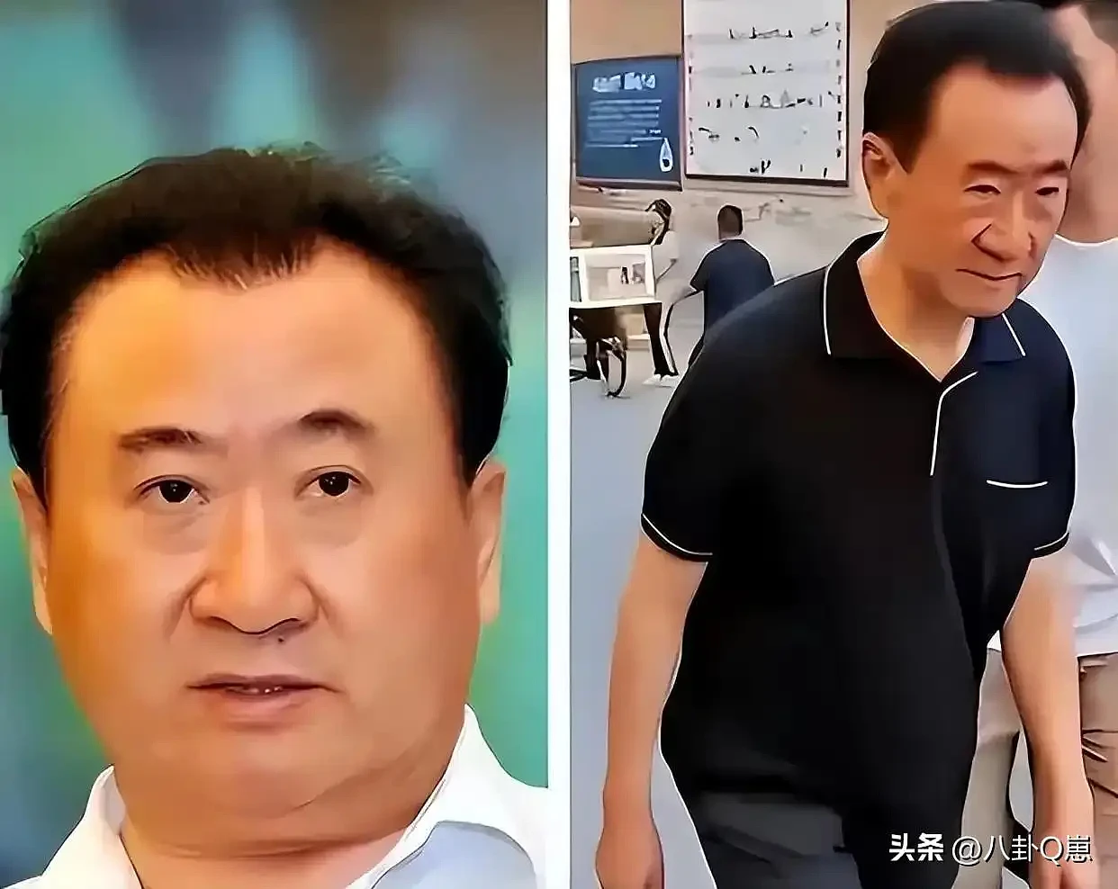王思聪大变样！暴瘦脱相还秃顶，父亲王健林自身难保（组图） - 4