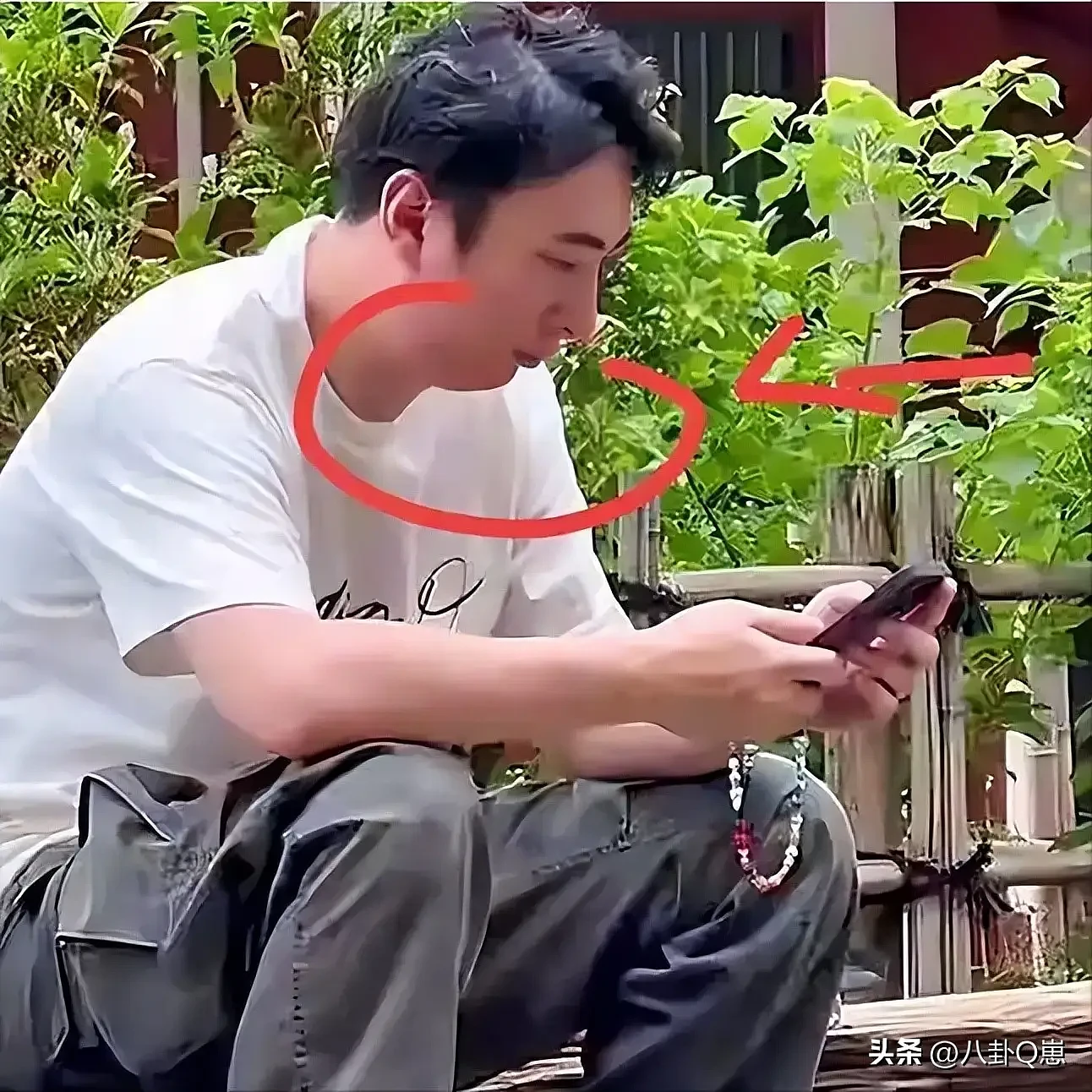 王思聪大变样！暴瘦脱相还秃顶，父亲王健林自身难保（组图） - 14