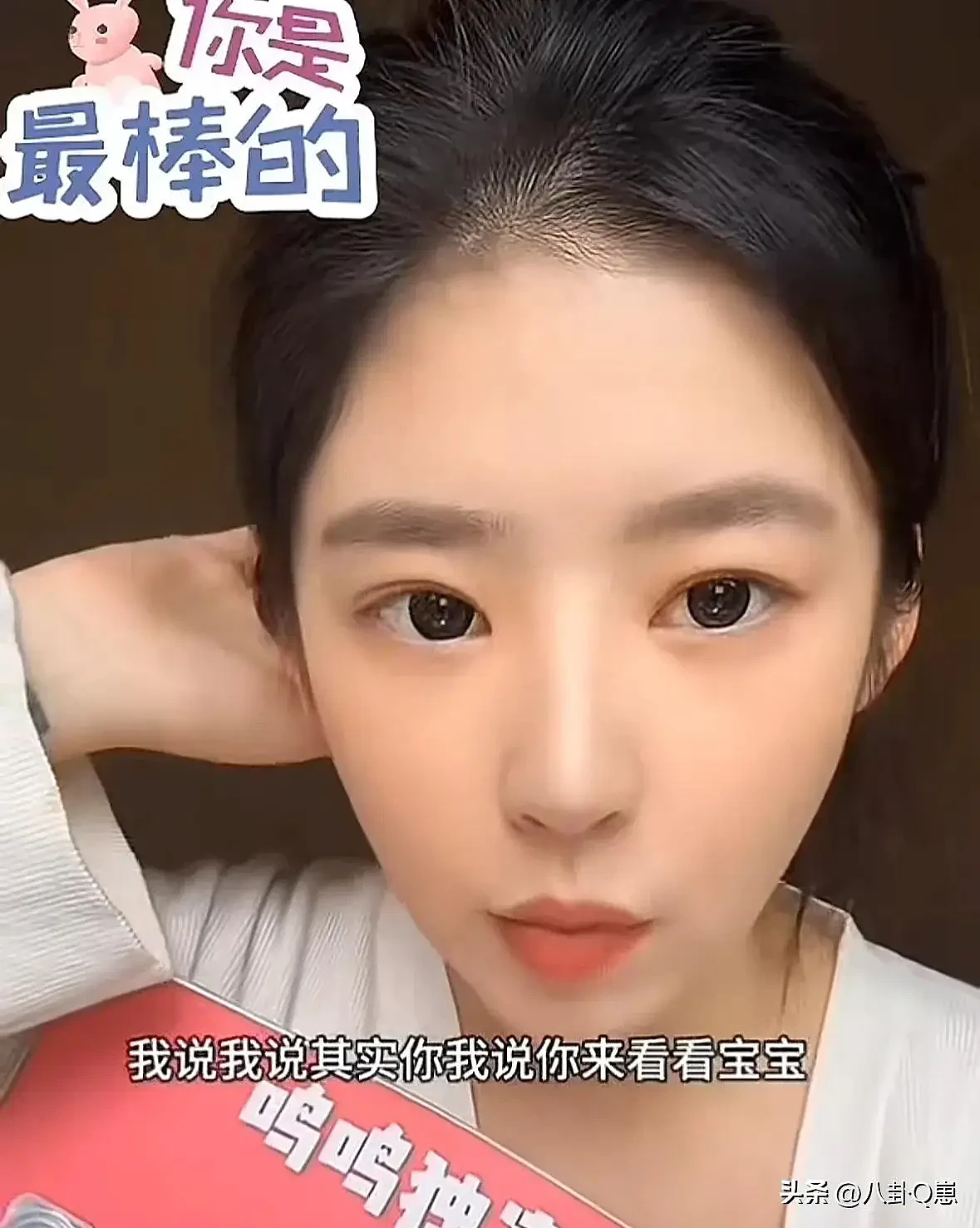 王思聪大变样！暴瘦脱相还秃顶，父亲王健林自身难保（组图） - 24