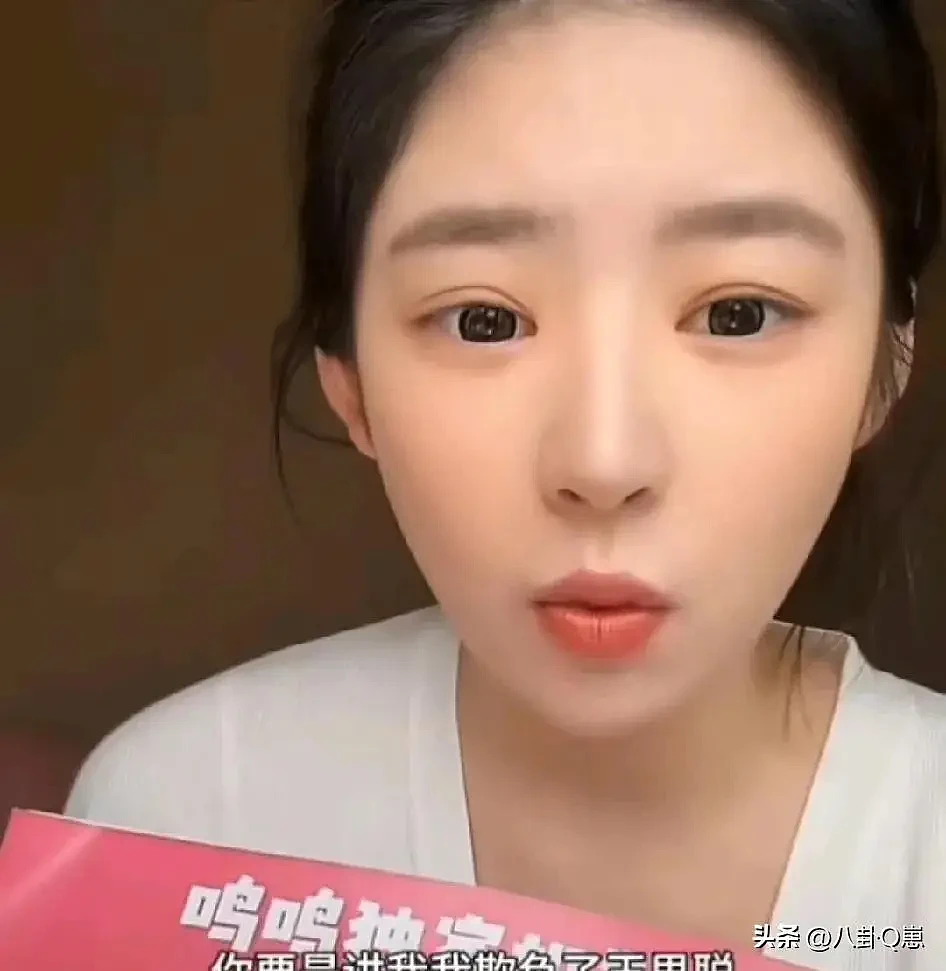 王思聪大变样！暴瘦脱相还秃顶，父亲王健林自身难保（组图） - 26