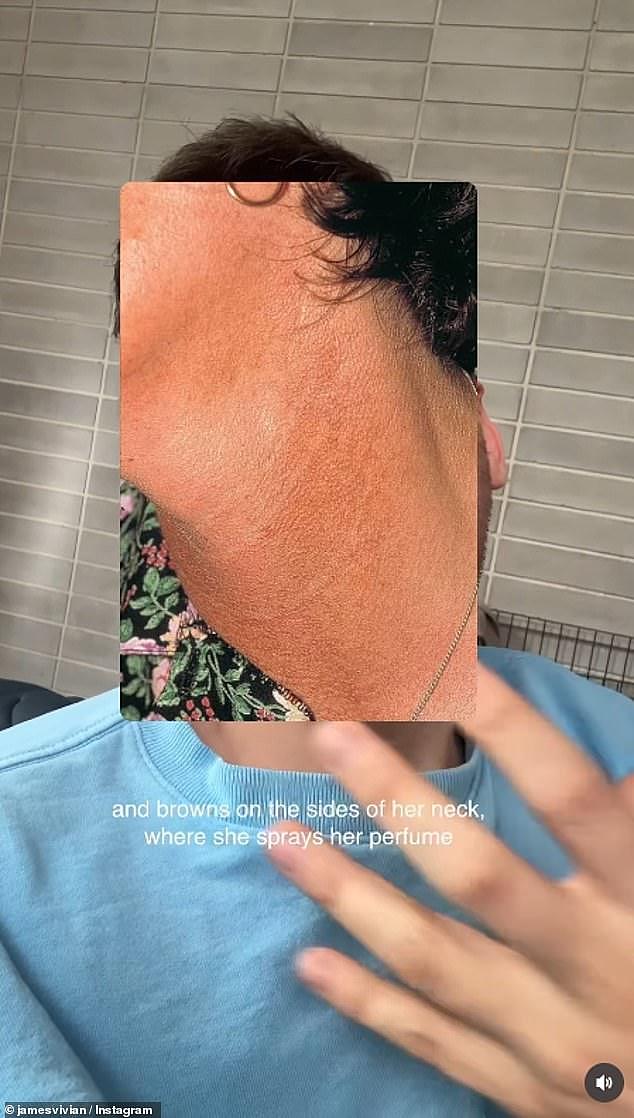 每年白花几百澳元买眼霜？澳护肤专家分享妙招：一支润唇膏就能搞定（组图） - 8