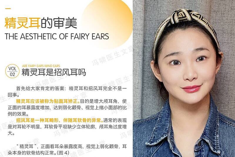 中国疯整形“精灵耳”，医揭多人术后终身残疾惨案（组图） - 2