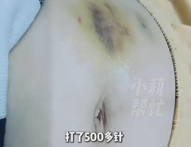 女子孕期收到丈夫不雅照，他竟出轨20多人！挨了500多针才生下的“珍贵儿”，离婚后被婆家抢走藏匿3个多月 - 7