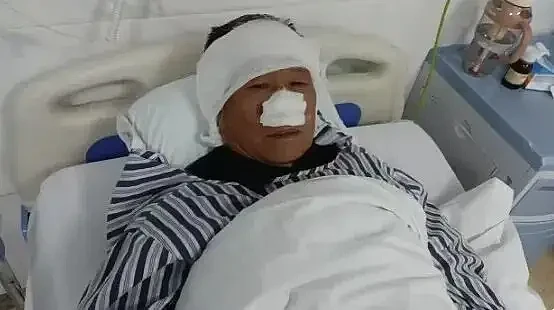 震惊！70岁老人与歹徒搏斗被咬掉鼻子还吞入肚中（组图） - 1