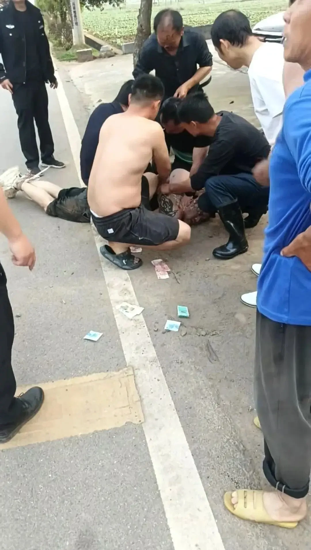 震惊！70岁老人与歹徒搏斗被咬掉鼻子还吞入肚中（组图） - 2