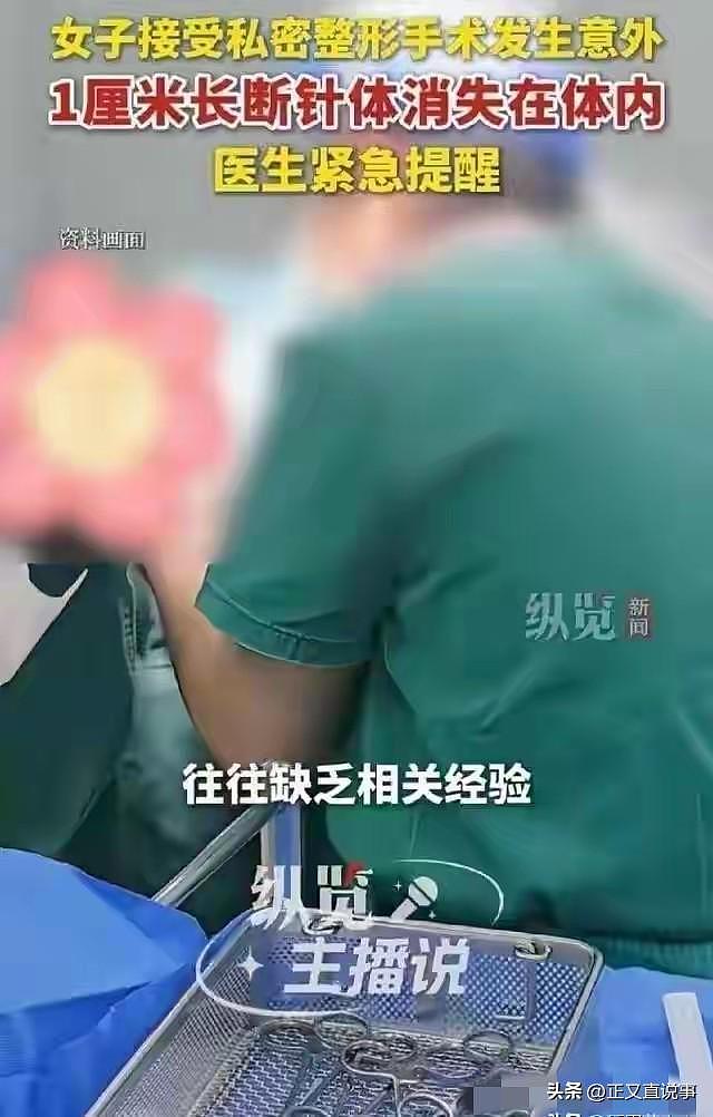 35岁女子去做私处紧缩，缝针断在肉里，医生徒手掏了半小时没找着 - 3