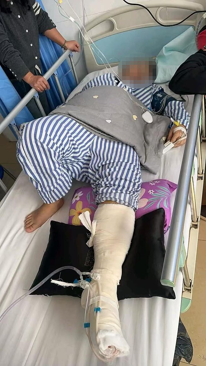 惊魂！女子称边充电边玩手机遭电击，全身多处受伤，本人：电流从手贯穿到脚，当天进ICU抢救 - 2