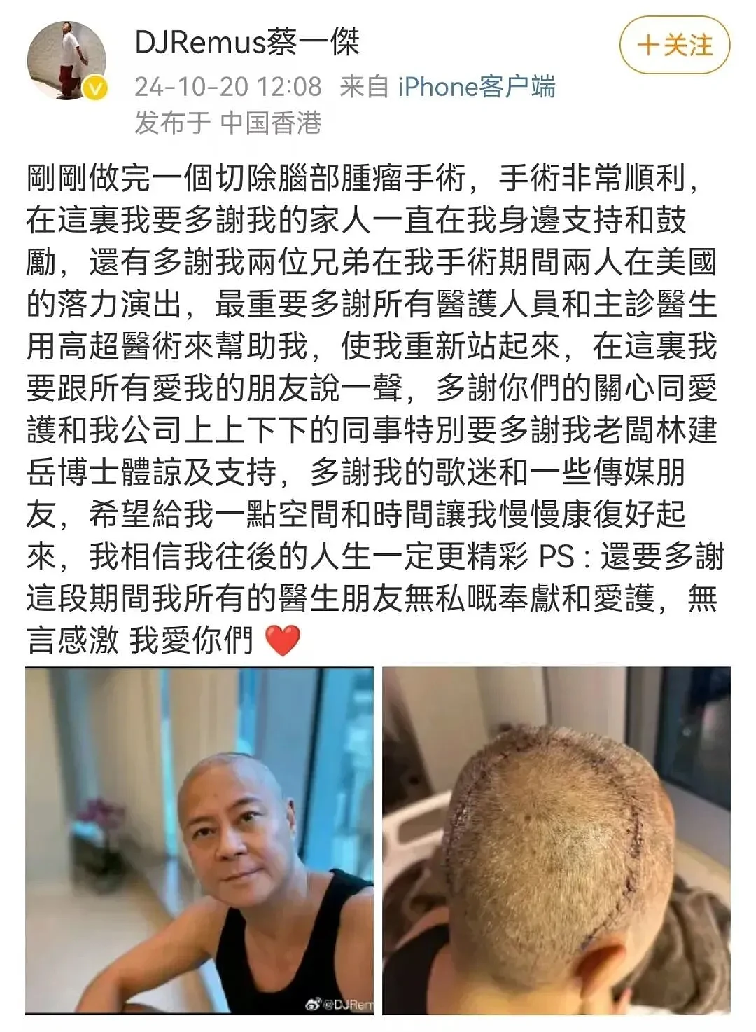 香港组合“草蜢”成员自曝,癌细胞已扩散(组图) - 2