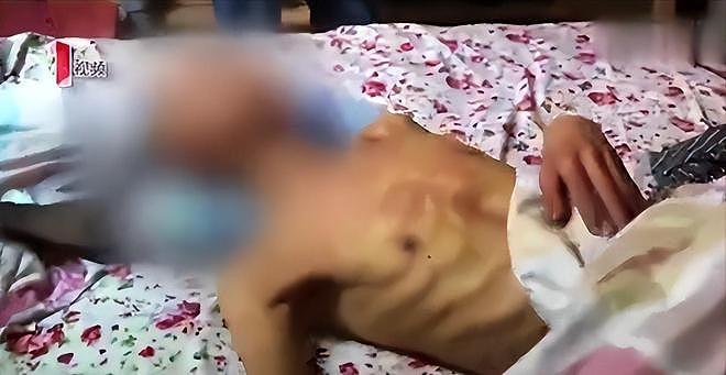 19岁男孩喝百草枯苦熬18天，逼在外打工母亲回家，母亲：你放心去（组图） - 14