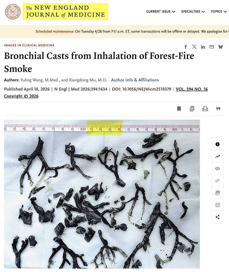 尴尬！中国医师投书国际顶尖医学期刊，用AI图露馅火速被撤稿（图） - 1