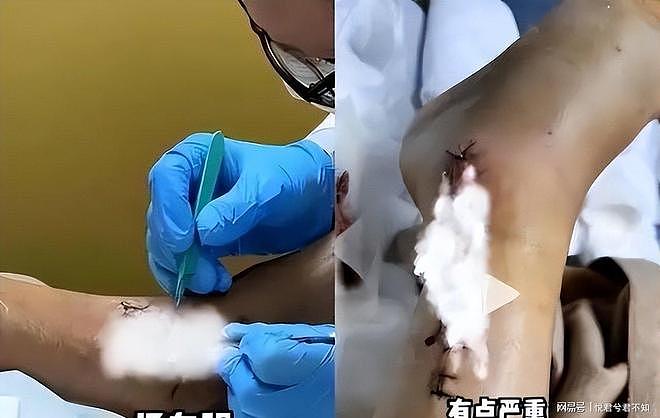 实惨!陈学冬2年4次手术,11部作品被下架!如今生活无法自理(组图) - 5