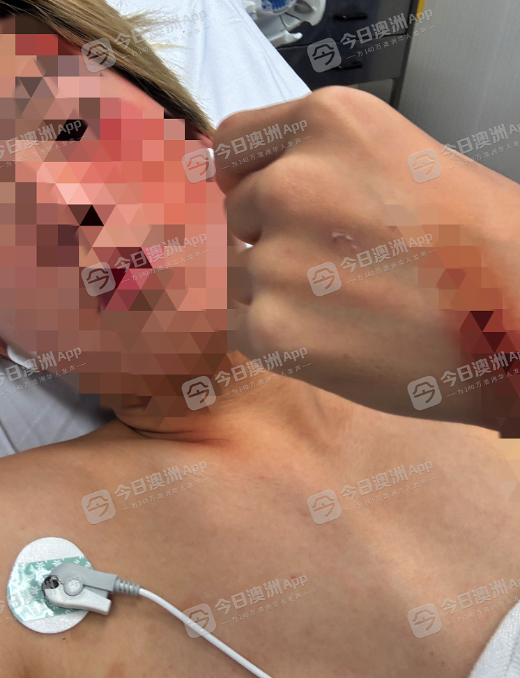 “要发讣告了！”华人少年澳洲跳伞失事，伞绳缠绕坠地，所幸大难不死！涉事基地事故频发，“16年7条人命”（视频/组图） - 2