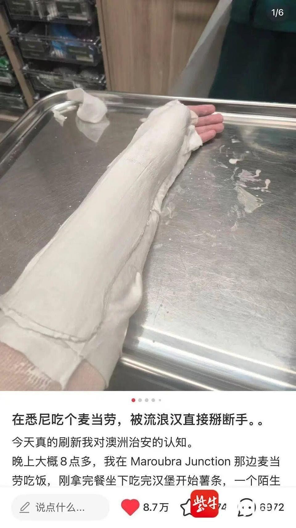 中国留学生悉尼麦当劳遭抢薯条致手断，连夜开发“助留”AI项目（组图） - 2