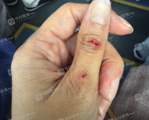 “她把我狠狠摔了出去！”澳洲华女华人区当街遇袭，报警仍被反复追打！批警方不力，华人副市长已跟进（视频/组图） - 3