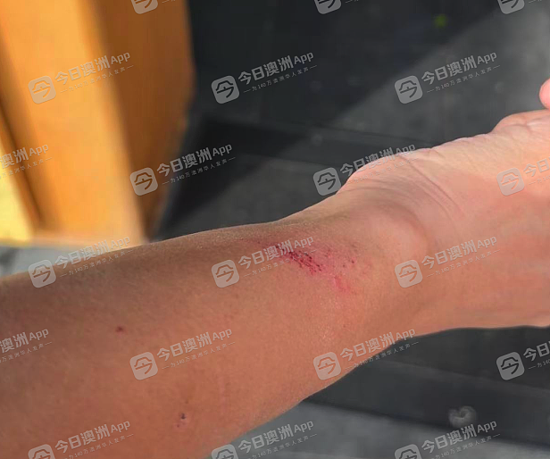 “王八蛋!狗娘养的!”澳洲华男重返12年前打工餐馆泄愤,认错东主爆冲突!现老板委屈:“冤有头债有主,你找对人啊”(视频/组图) - 3