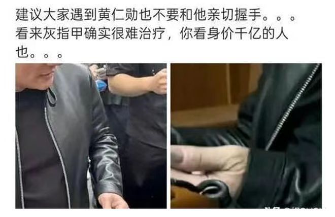 黄仁勋被全网确诊灰指甲？高清镜头曝光，网友：千万别和他握手！ - 2
