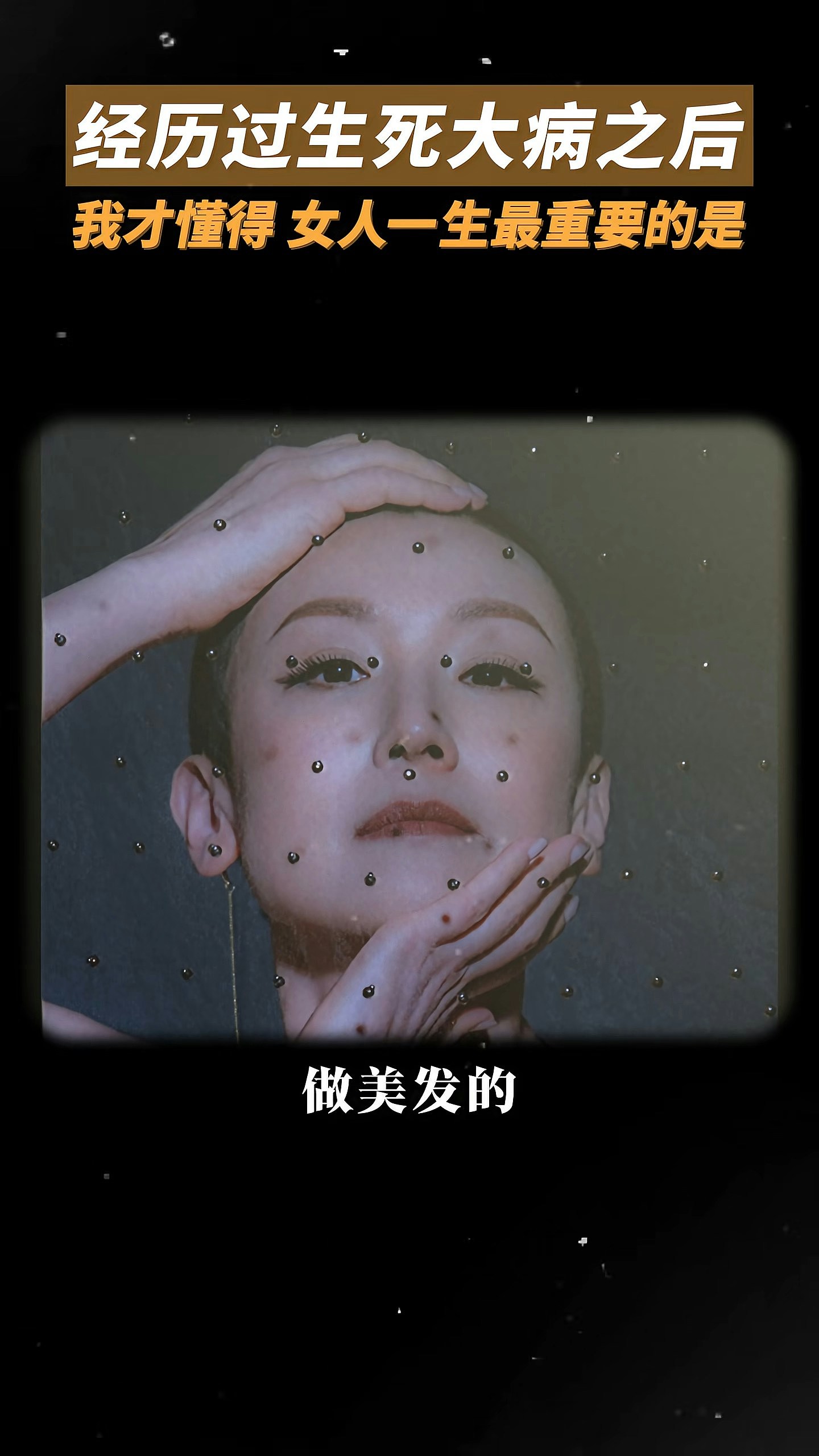 落选港姐晒剃光头抗病照,亲揭私家医院天价医药费:一针标靶20万 - 10