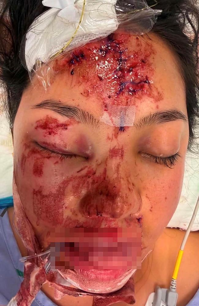 澳女新西兰度假酿惨剧!骑摩托坠墙遭重压,姐姐崩溃:以为活不成了(组图) - 4