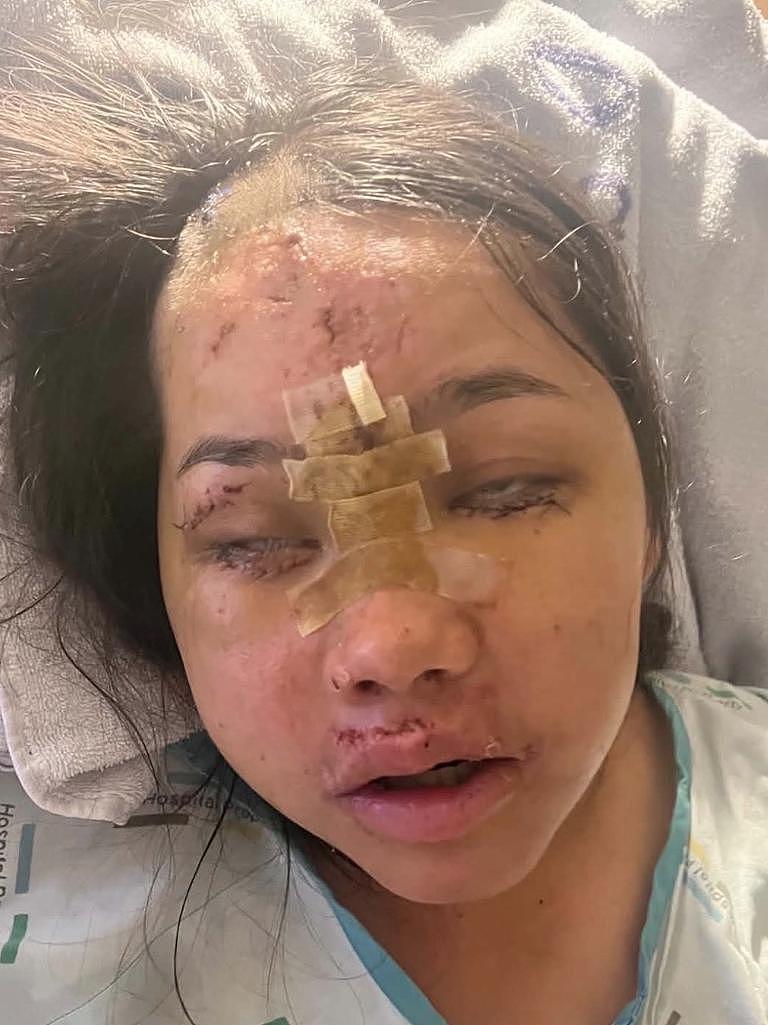澳女新西兰度假酿惨剧!骑摩托坠墙遭重压,姐姐崩溃:以为活不成了(组图) - 6