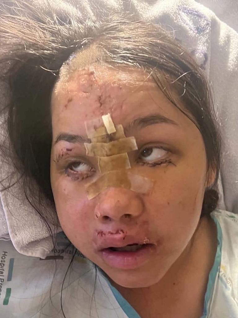 澳女新西兰度假酿惨剧!骑摩托坠墙遭重压,姐姐崩溃:以为活不成了(组图) - 9