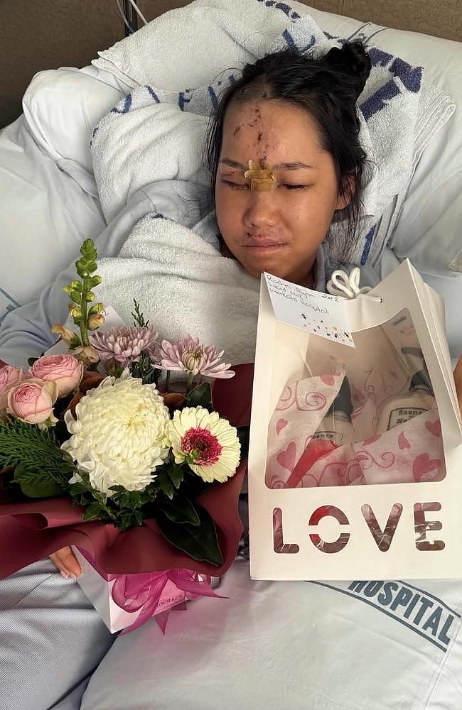 澳女新西兰度假酿惨剧!骑摩托坠墙遭重压,姐姐崩溃:以为活不成了(组图) - 12