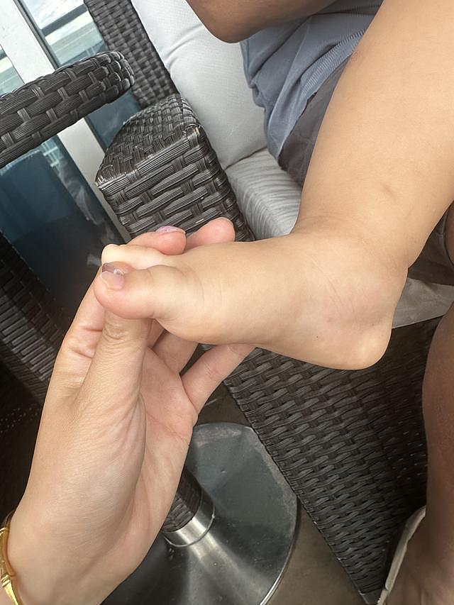 39岁博主“哈尼小微”突然离世,亲属:被虫咬后感染,此前多日吃不下饭(组图) - 3