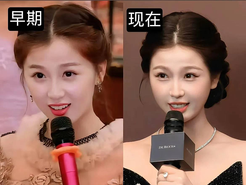 男星爆虞书欣大学就整形? 粉丝晒对比照护主(组图) - 2
