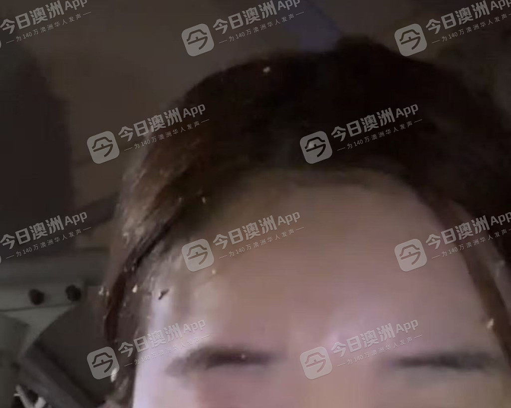 WHV华女抵澳不足一月即遇袭,无端遭拳击头部送院治疗!“原以为这里是安全的”(视频/组图) - 1