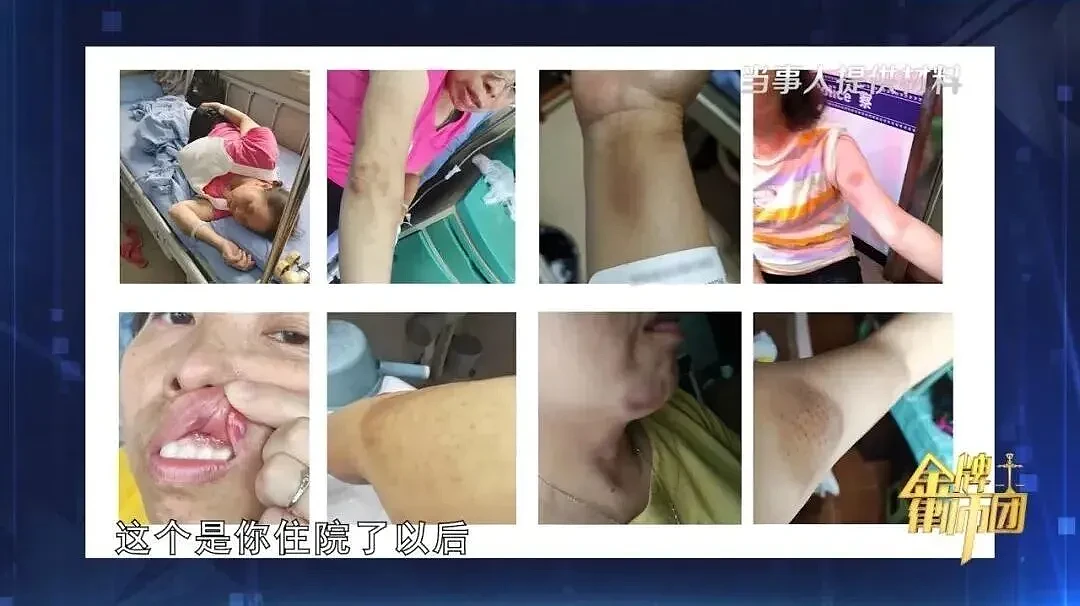 53岁女子忍受10年家暴拍下132张伤情照,法院判了(组图) - 3