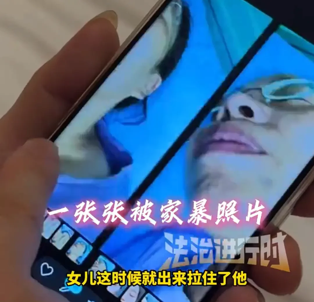 53岁女子忍受10年家暴拍下132张伤情照,法院判了(组图) - 12
