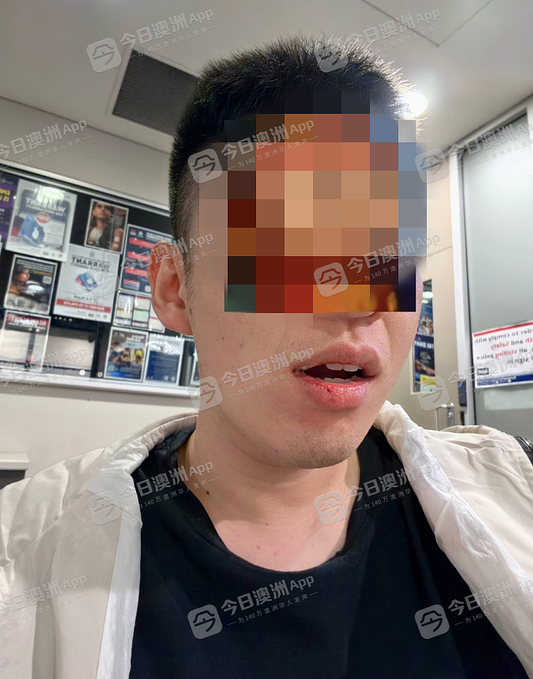 “该死的中国佬！”澳洲华男火车上无端遇袭，遭种歧辱骂拳击面部！报警维权遥遥无期（组图） - 1