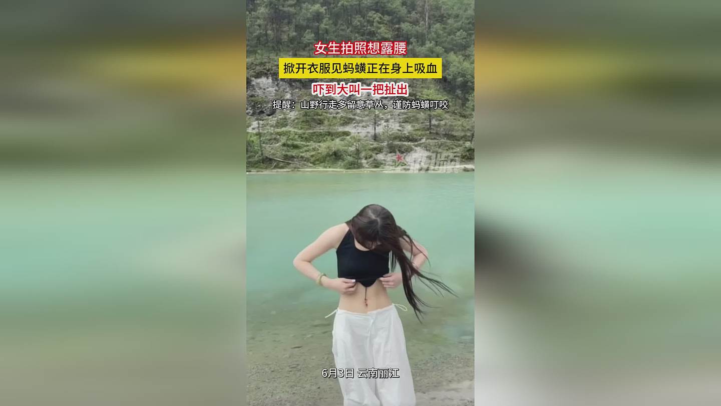 云南一女生露腰拍照发现蚂蟥钻进皮肤，揪出后伤口持续流血5小时（组图） - 1