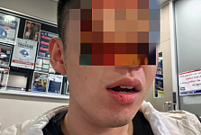 “该死的中国佬！”澳洲华男火车上无端遇袭，遭种歧辱骂拳击面部！报警维权遥遥无期（组图）