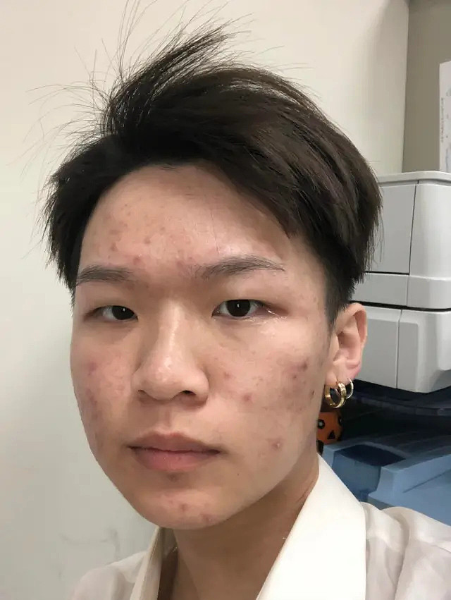 “幼态脸”、“精灵耳”与“天鹅颈” 台湾人为何开始到上海“跨境医美”?（组图） - 7