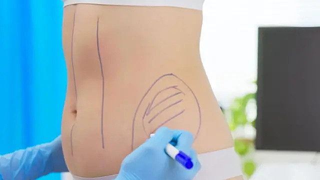 “幼态脸”、“精灵耳”与“天鹅颈” 台湾人为何开始到上海“跨境医美”?（组图） - 9