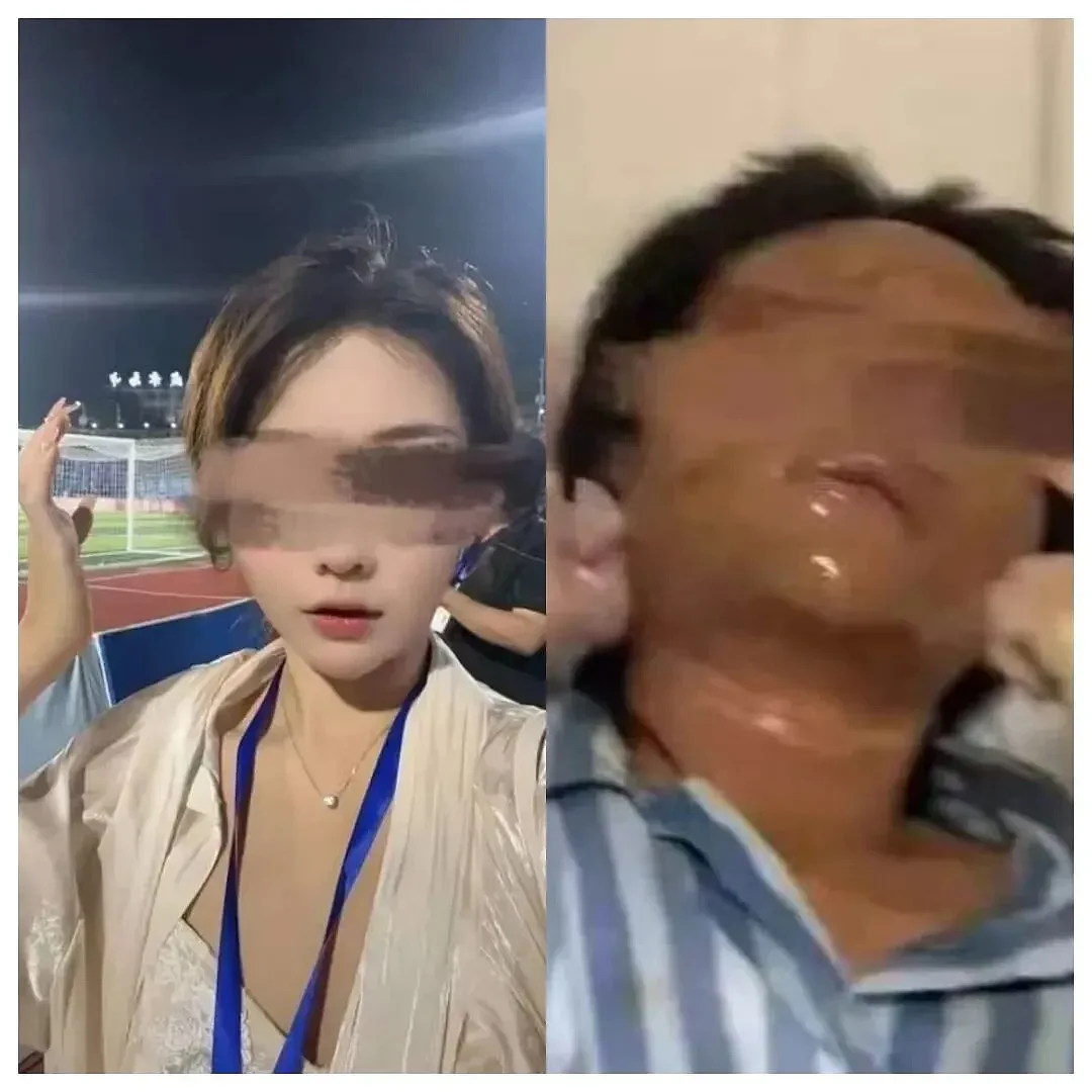 湖南男子求爱不成多次报复：泼强酸、放置爆炸物致女主播毁容（组图） - 1