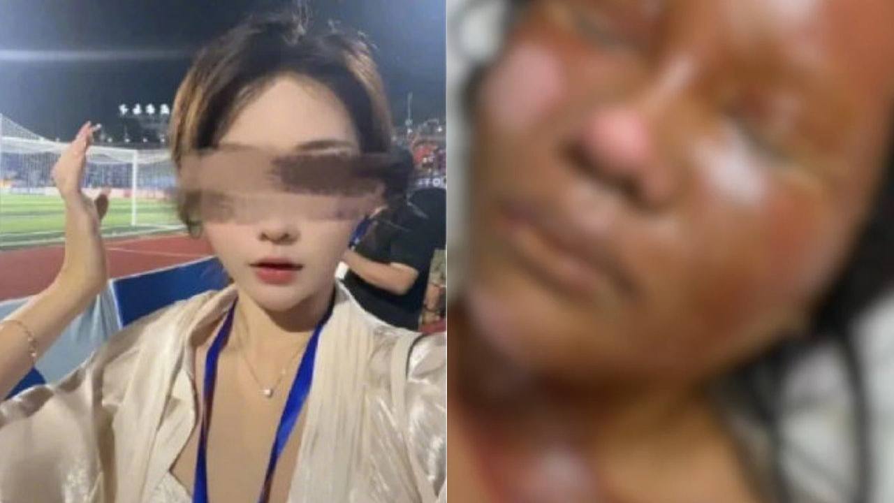 女主播拒爱狂迷,遭其自制炸弹炸致脸部严重烧伤!恶徒开庭拒认罪(组图) - 1