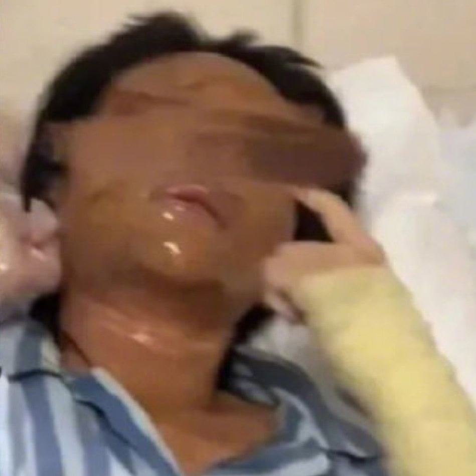 女主播拒爱狂迷,遭其自制炸弹炸致脸部严重烧伤!恶徒开庭拒认罪(组图) - 2