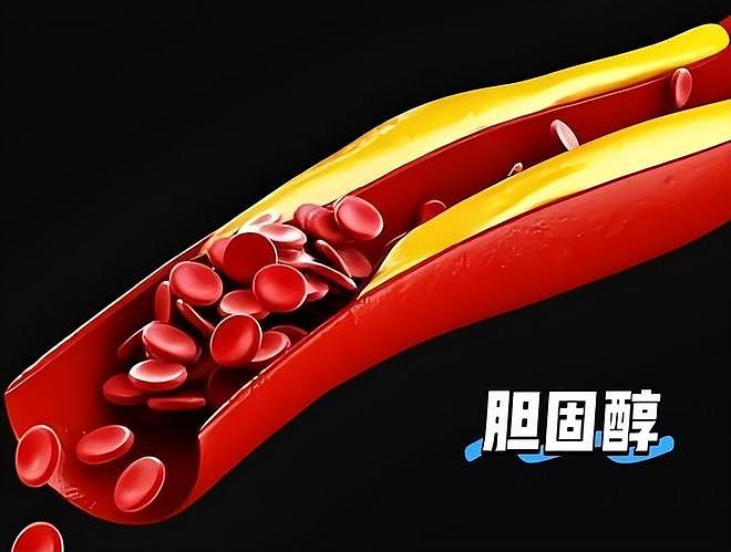 “胆固醇凶手”被揪出,是蛋黄的15倍!医生:很多人天天都在吃(组图) - 4
