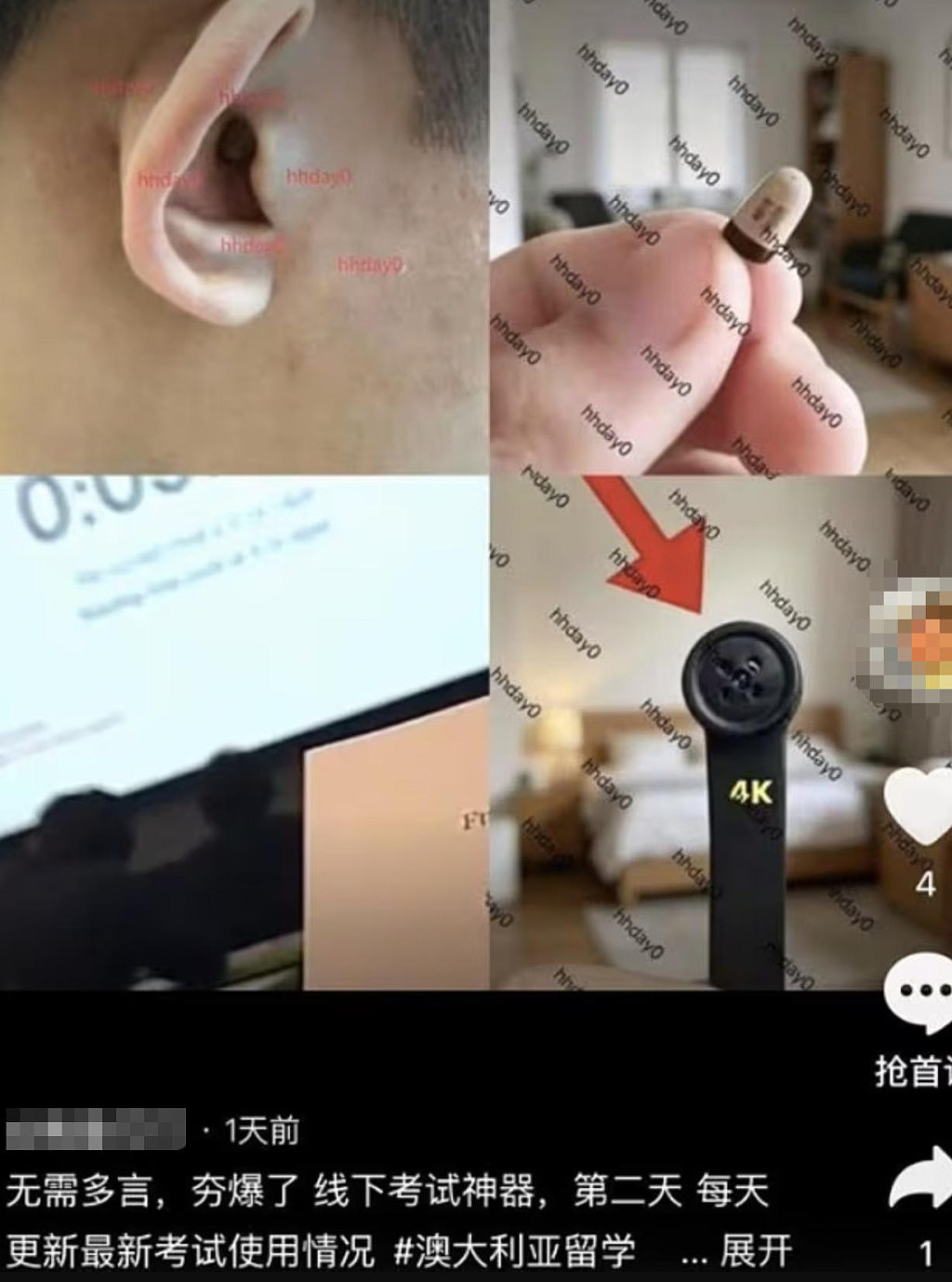 抖音、小红书疯传!悉尼大学考题泄露,学生疑用纽扣摄像头偷拍(组图) - 2