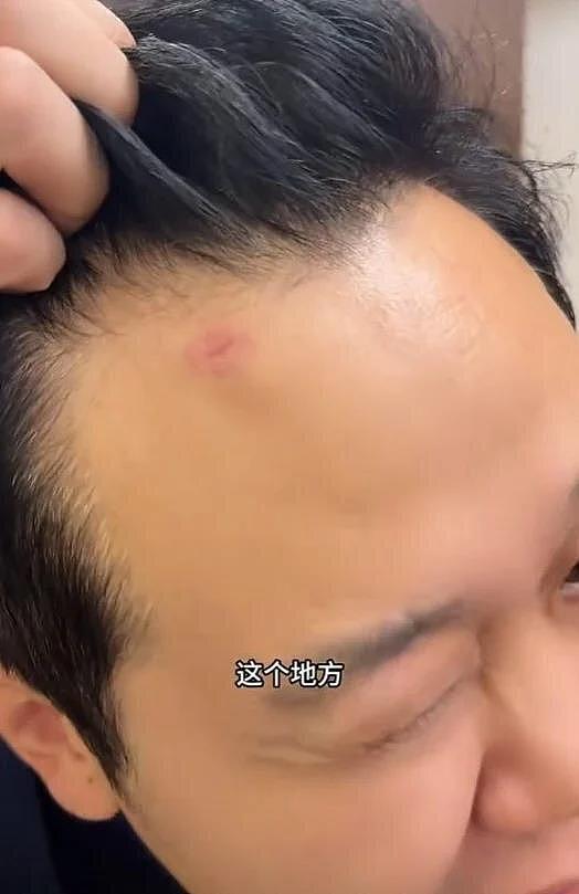 被枪指著脑门…抵墨西哥才半小时，中国球迷遇抢劫 - 2