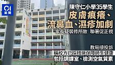 香港小学35名学生皮肤痒流鼻血，家长疑与装修有关，联署要求彻查（组图）