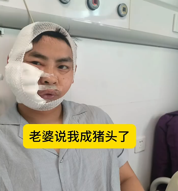 中国长沙海洋馆鲨鱼咬伤潜水游客,全网围观:湖南史上第一人(组图) - 1